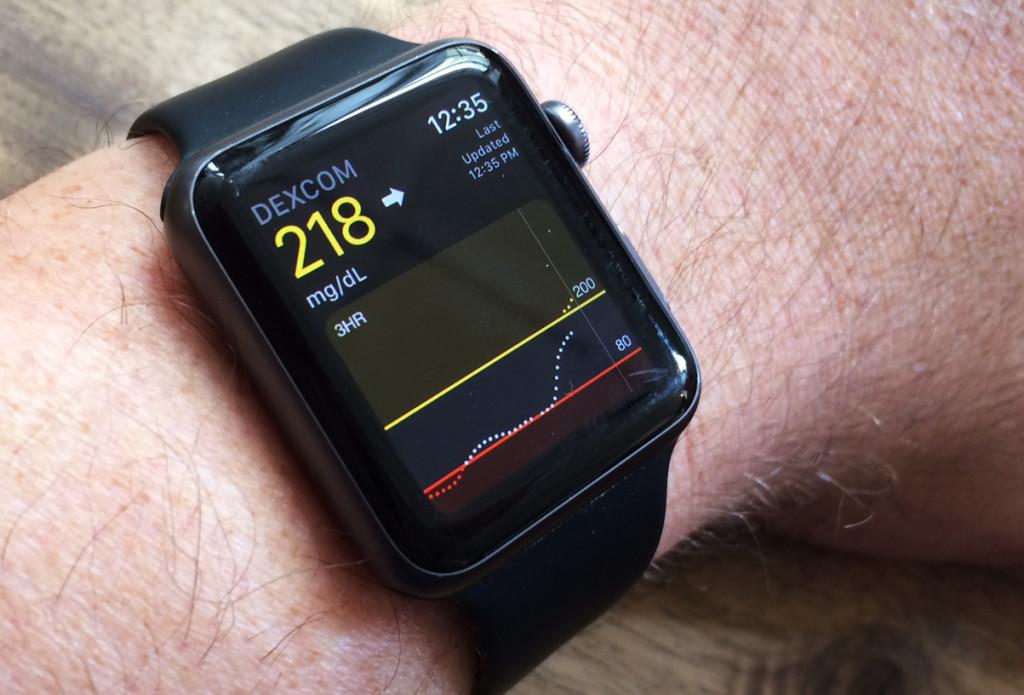 Blood sugar info on my Apple Watch