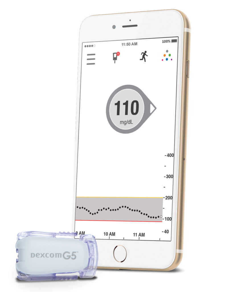 Dexcom G5 transmitter and iPhone